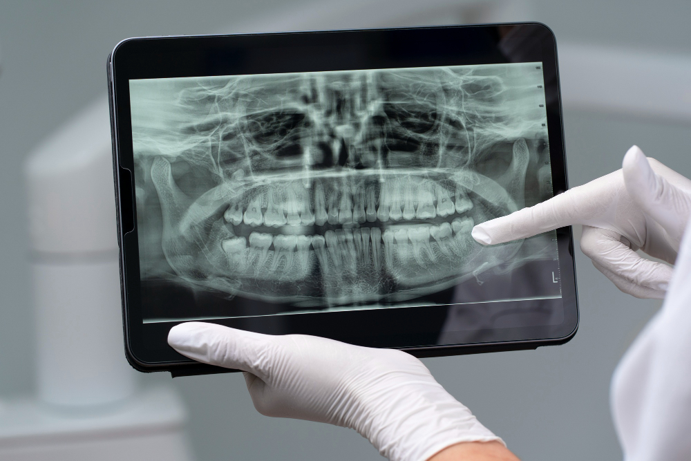 Digital X-Rays in Honolulu
