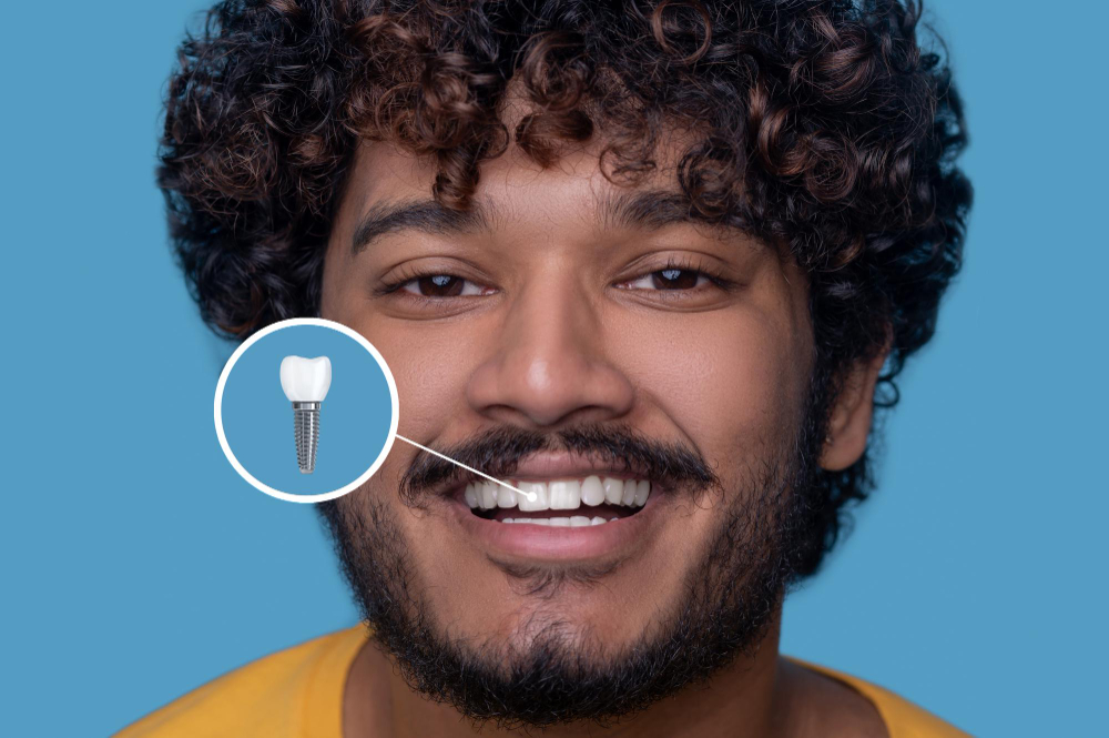 Implant Restoration in Honolulu