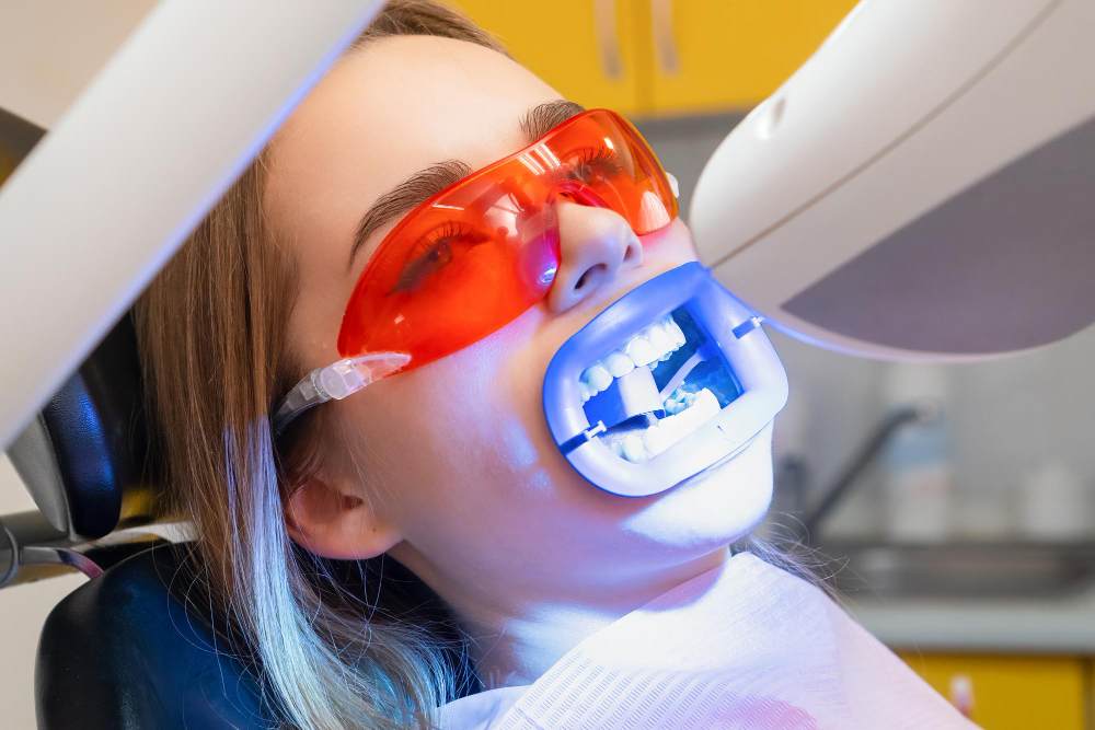 Teeth Whitening in Honolulu