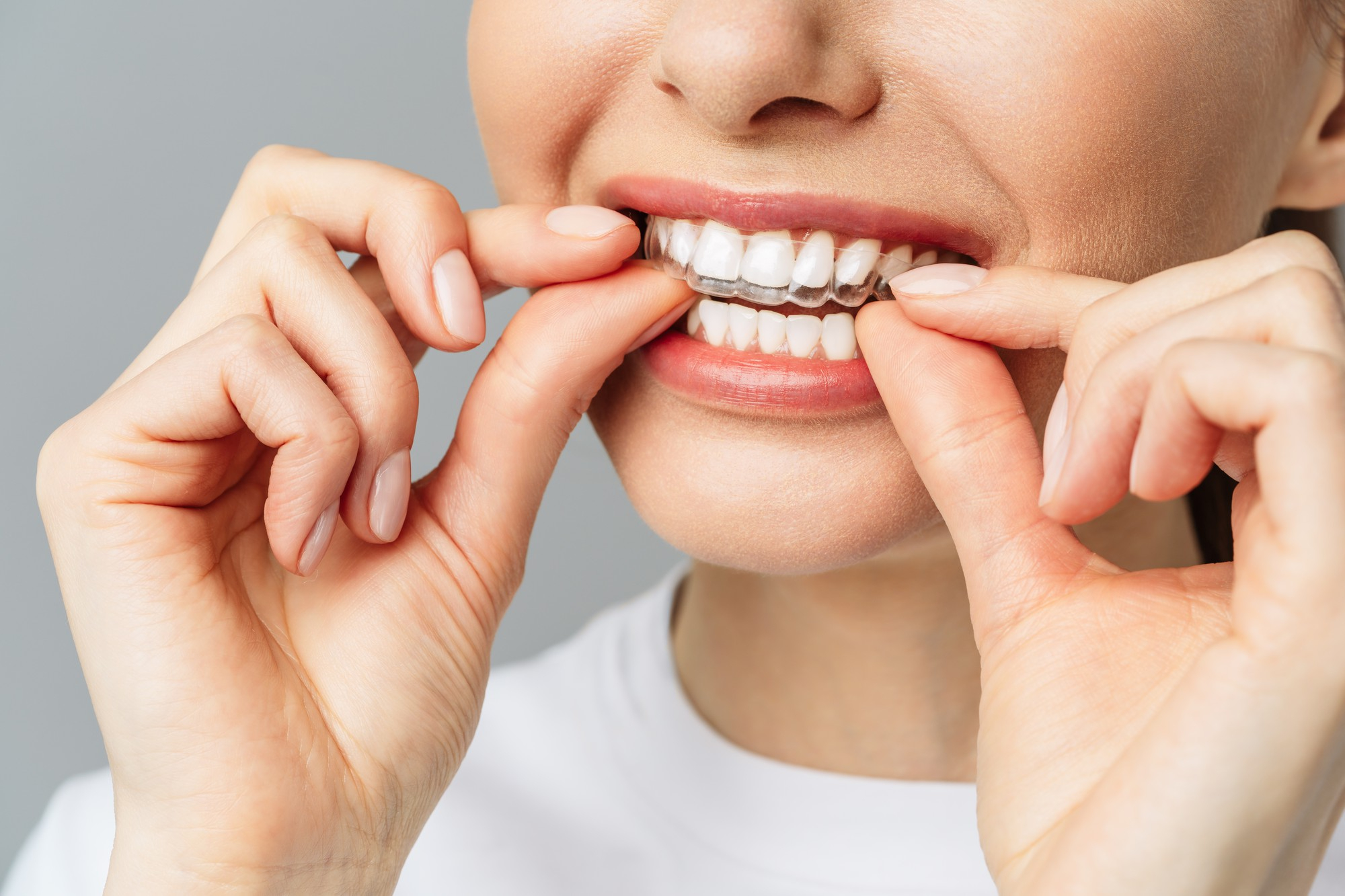 Invisalign® & Better Sleep